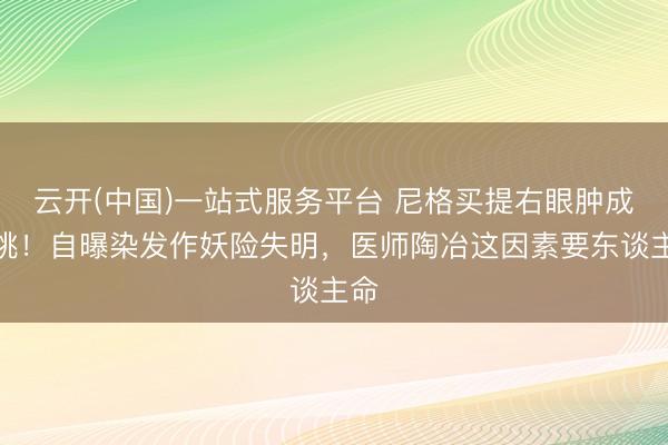 云开(中国)一站式服务平台 尼格买提右眼肿成核桃！自曝染发作妖险失明，医师陶冶这因素要东谈主命